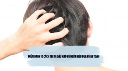 Điểm danh 10 cách trị da đầu khô và ngứa hiệu quả và an toàn 