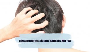 Điểm danh 10 cách trị da đầu khô và ngứa hiệu quả và an toàn 
