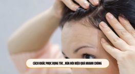 Cách khắc phục rụng tóc , xóa hói hiệu quả nhanh chóng 