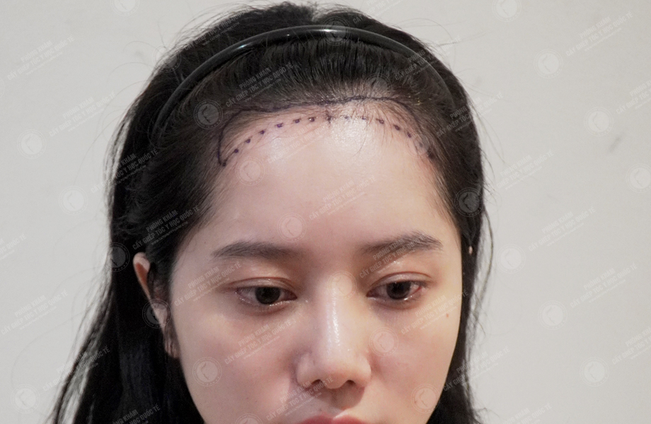 Phạm Ánh Nguyệt -  2