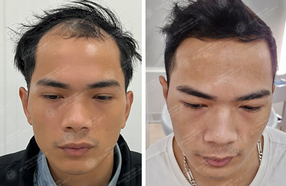  Trần Việt Dũng -  1