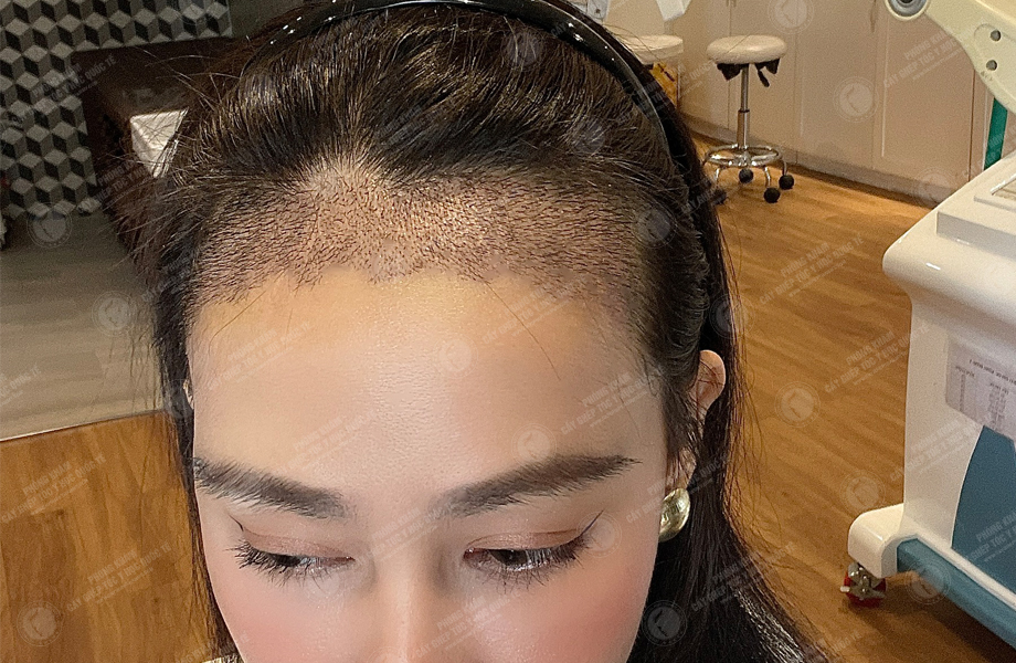 Á hậu Phạm Kim Duyên - Cấy tóc đường chữ M 5