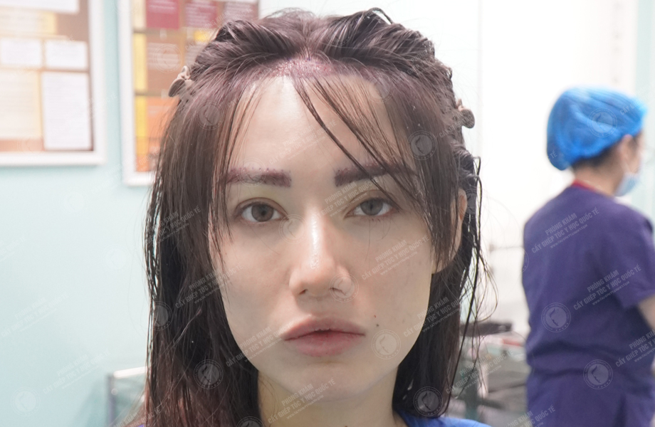 LyDie Vũ - Cấy lông mày 5