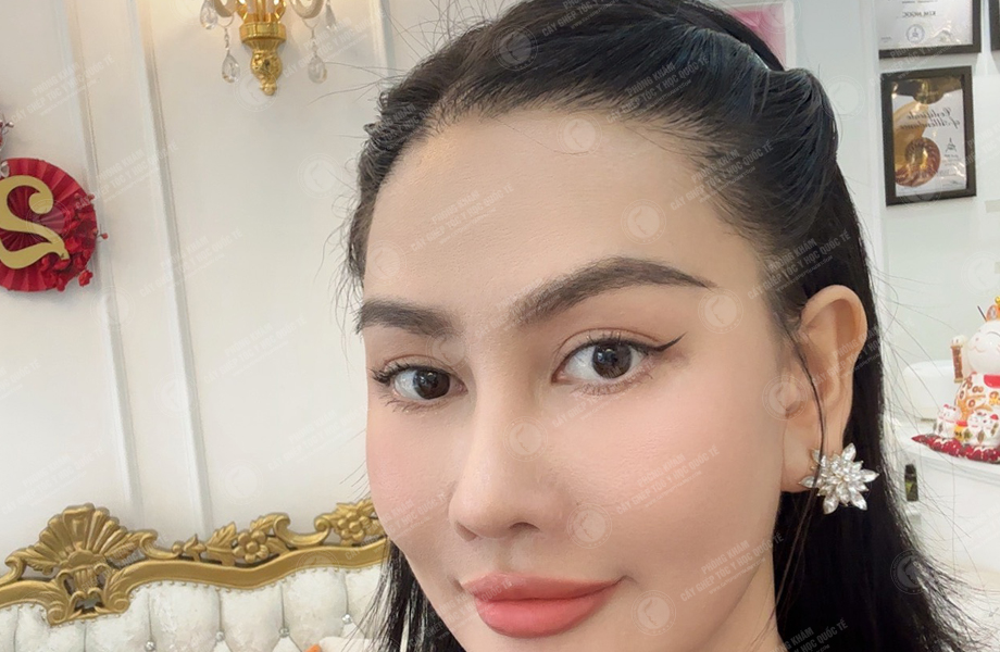 Á hậu Phạm Kim Duyên - Cấy tóc đường chữ M 8