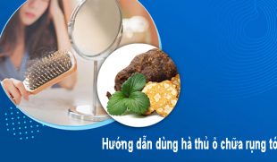 Hướng dẫn dùng hà thủ ô chữa rụng tóc an toàn tại nhà