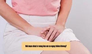 Nổi mụn nhọt ở vùng kín nữ có nguy hiểm không?