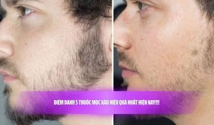 Điểm danh 5 thuốc mọc râu hiệu quả nhất hiện nay!!! 