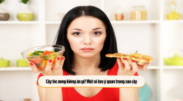 Cấy tóc xong kiêng ăn gì? Một số lưu ý quan trọng sau cấy