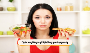 Cấy tóc xong kiêng ăn gì? Một số lưu ý quan trọng sau cấy