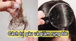 Tổng hợp những cách trị gàu và giảm rụng tóc hiệu quả
