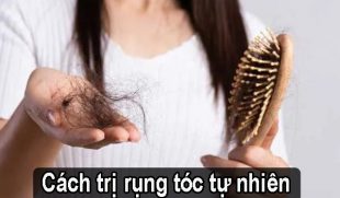 Những cách trị rụng tóc tự nhiên tại nhà bạn có thể tham khảo