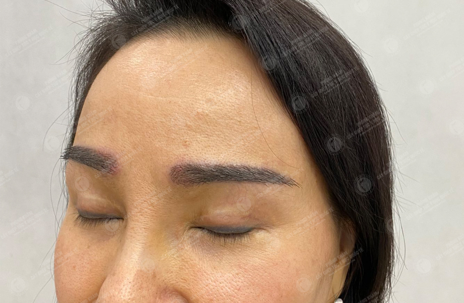 Vũ Ngọc Huyền - Cấy lông mày 7