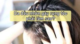 Da đầu nhờn gây rụng tóc khắc phục như thế nào?