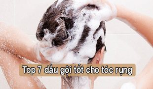 Top 7 loại dầu gội tốt cho tóc rụng bạn nên thử