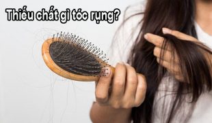 Thiếu chất gì tóc rụng? Xem ngay để bổ sung kịp thời
