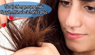 Tóc bị chẻ ngọn rụng nhiều: Nguyên nhân và cách khắc phục hiệu quả