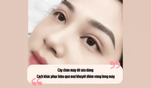 Cấy chân mày để sửa dáng: Cách khắc phục hiệu quả mọi khuyết điểm vùng lông mày