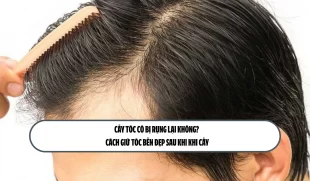 Cấy tóc có bị rụng lại không? Cách giữ tóc bền đẹp sau khi khi cấy