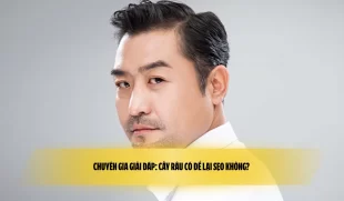 Chuyên gia giải đáp: Cấy râu có để lại sẹo không? 