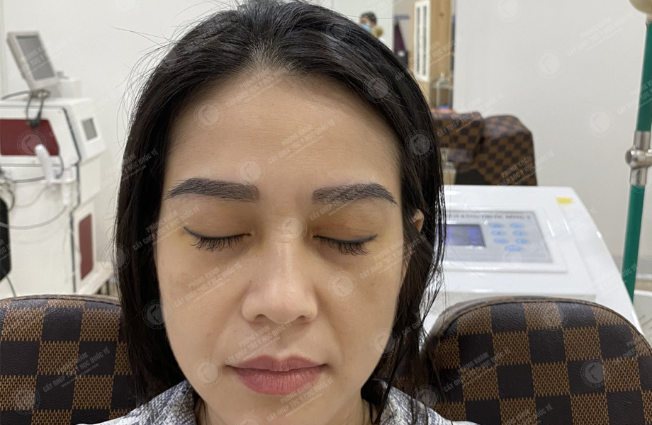 Phạm Thị Ánh - Cấy lông mày 5
