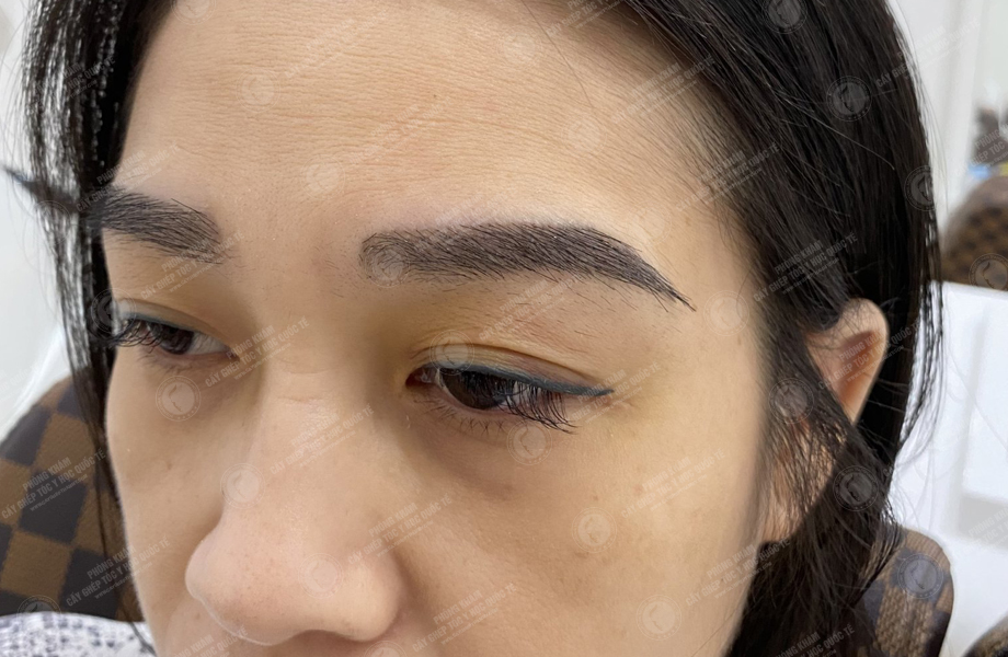 Phạm Thị Ánh - Cấy lông mày 2