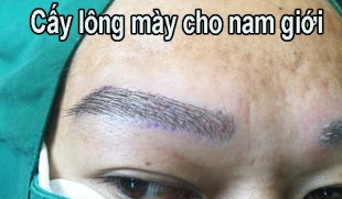 Cấy lông mày cho nam giới chuẩn soái ca