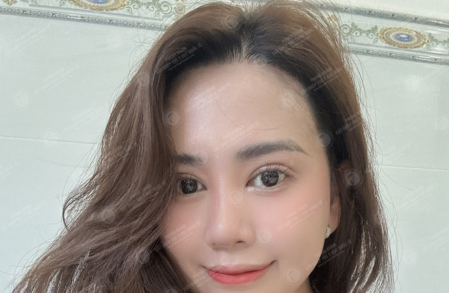 Đào Lan  Phương - Cấy tóc đường chữ M 6