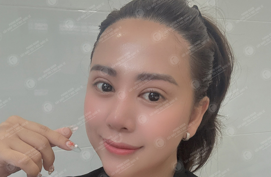 Đào Lan  Phương - Cấy tóc đường chữ M 8