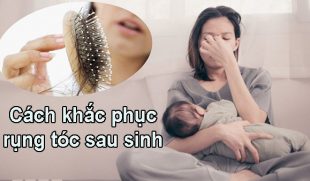 Khám phá cách khắc phục rụng tóc sau sinh hiệu quả nhất