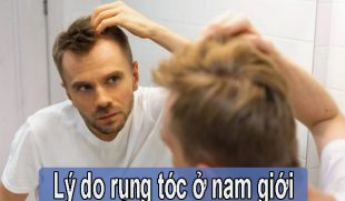 Lý do tóc rụng nam giới và cách điều trị hiệu quả