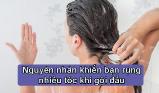Tìm hiểu nguyên nhân khiến bạn rụng rất nhiều tóc khi gội đầu