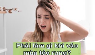[Tìm hiểu] : Phải làm gì khi vào mùa tóc rụng?