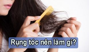 Rụng tóc nên làm gì? Lời khuyên từ bác sĩ chuyên khoa