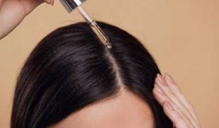 Top 3 thuốc mọc tóc nhanh hiệu quả được nhiều người tin dùng