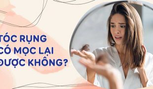 [Tìm Hiểu] : Tóc rụng nhiều có mọc lại không?