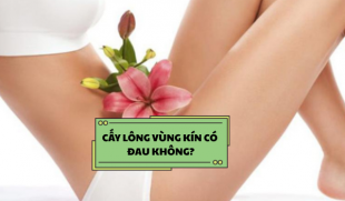 Cấy lông vùng kín có đau không? Giải đáp chi tiết từ chuyên gia