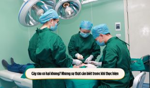 Cấy râu có hại không? Những sự thật cần biết trước khi thực hiện