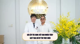 Giá cấy tóc nam: Hết bao nhiêu tiền? Gợi ý địa chỉ uy tín thực hiện