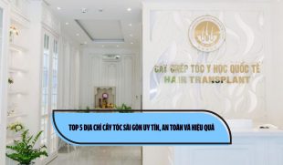 Top 5 địa chỉ cấy tóc Sài Gòn uy tín, an toàn và hiệu quả