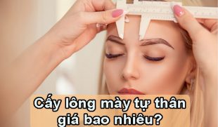Cấy lông mày tự thân giá bao nhiêu? Có nên đầu tư không?
