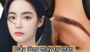 Cấy lông mày tự thân là gì – Giải pháp thẩm mỹ an toàn, hiệu quả lâu dài