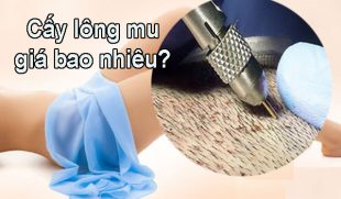Cấy lông mu giá bao nhiêu? Quy trình, chi phí & địa chỉ uy tín 2025