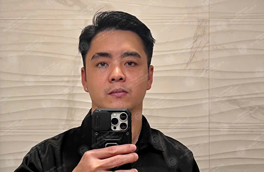 Nguyễn Lạc Quân - Cấy tóc đường chữ M 7