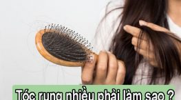 [Giải Đáp]: Tóc rụng nhiều phải làm sao?