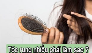 [Giải Đáp]: Tóc rụng nhiều phải làm sao?