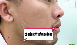 Có nên cấy râu không? Giải đáp từ chuyên gia thẩm mỹ