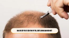 Địa chỉ cấy tóc ở Cần Thơ uy tín, chất lượng bạn nên biết