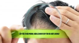 Cấy tóc ở Hải Phòng: Đâu là đơn vị uy tín và chất lượng? 