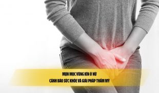 Mụn mọc vùng kín ở nữ: Cảnh báo sức khỏe và giải pháp thẩm mỹ
