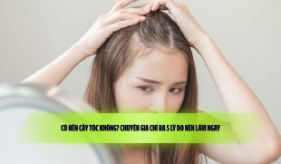 Có nên cấy tóc không? Chuyên gia chỉ ra 5 lý do nên làm ngay